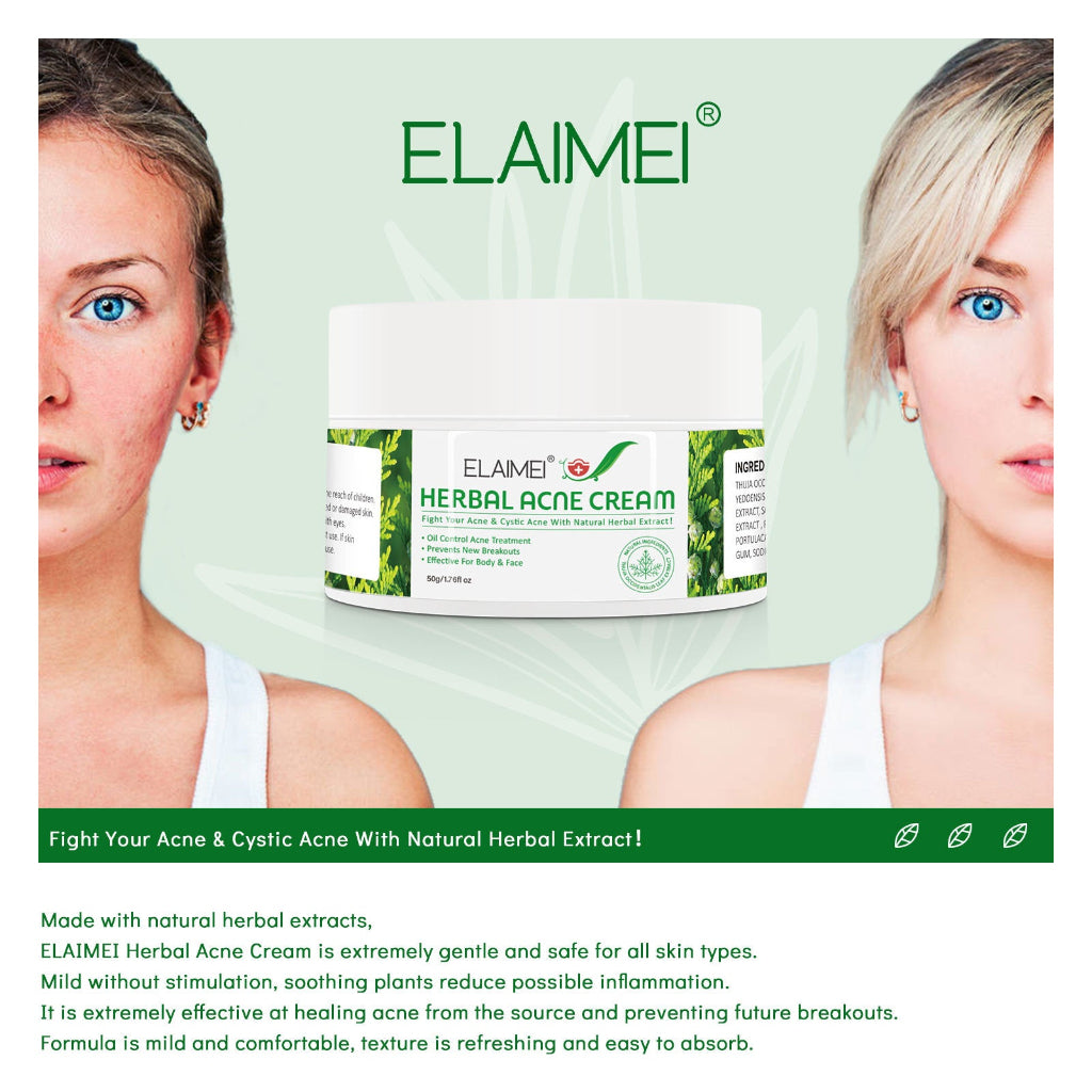 Organic herbal acne cream
Anti-acne face cream with natural extracts
Pimple removal cream
Whitening and moisturizing acne treatment
Herbal facial cream for clear skin
Natural acne solution for sensitive skin
Botanical anti-acne moisturizer
Herbal skincare for pimples and blemishes
Acne cream with Thuja and Sophora
Gentle herbal cream for oily skin