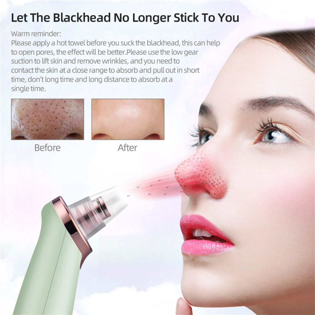Electric blackhead remover
Pore vacuum cleaner
Acne suction beauty device
Blackhead removal tool
Chayin blackhead suction machine
Deep pore cleansing device
Facial vacuum for acne and grease
Multi-head blackhead extractor
Rechargeable pore cleaner
Gentle suction skin care tool