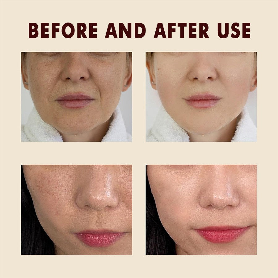 Give your skin the exceptional care it deserves with this ampoule that combines effectiveness and gentleness.