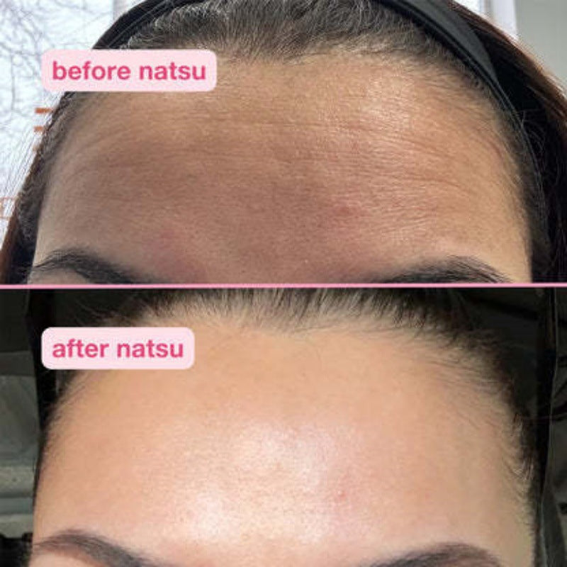 Transform your beauty routine with this professional kit that gives you a lifted and rejuvenated face in seconds!