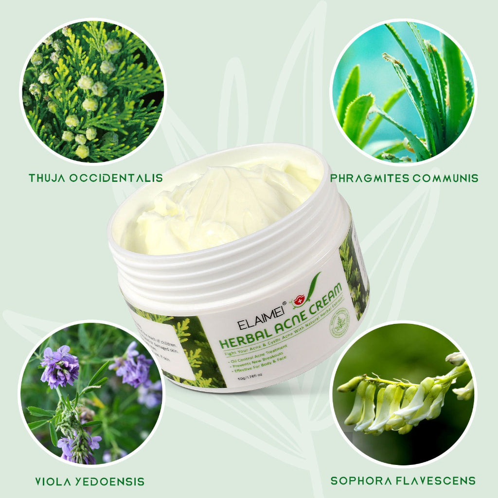Organic herbal acne cream
Anti-acne face cream with natural extracts
Pimple removal cream
Whitening and moisturizing acne treatment
Herbal facial cream for clear skin
Natural acne solution for sensitive skin
Botanical anti-acne moisturizer
Herbal skincare for pimples and blemishes
Acne cream with Thuja and Sophora
Gentle herbal cream for oily skin