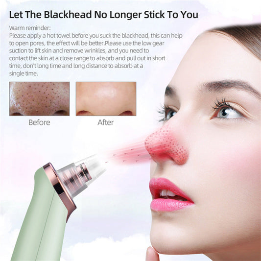 Electric blackhead remover
Pore vacuum cleaner
Acne suction beauty device
Blackhead removal tool
Chayin blackhead suction machine
Deep pore cleansing device
Facial vacuum for acne and grease
Multi-head blackhead extractor
Rechargeable pore cleaner
Gentle suction skin care tool